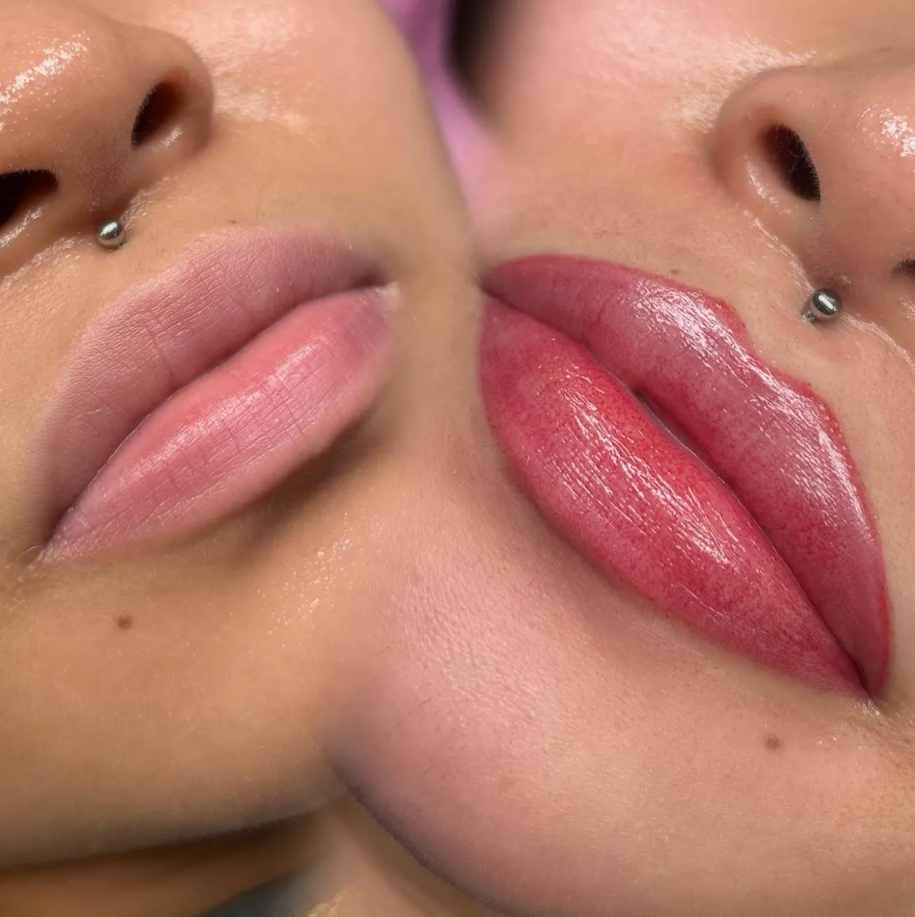 Touraine Filvert | Eating After Lip Neutralization Aftercare Tips